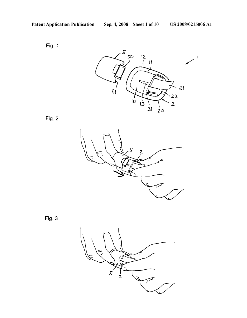 Medical Device with Transcutaneous Cannula Device - diagram, schematic, and image 02