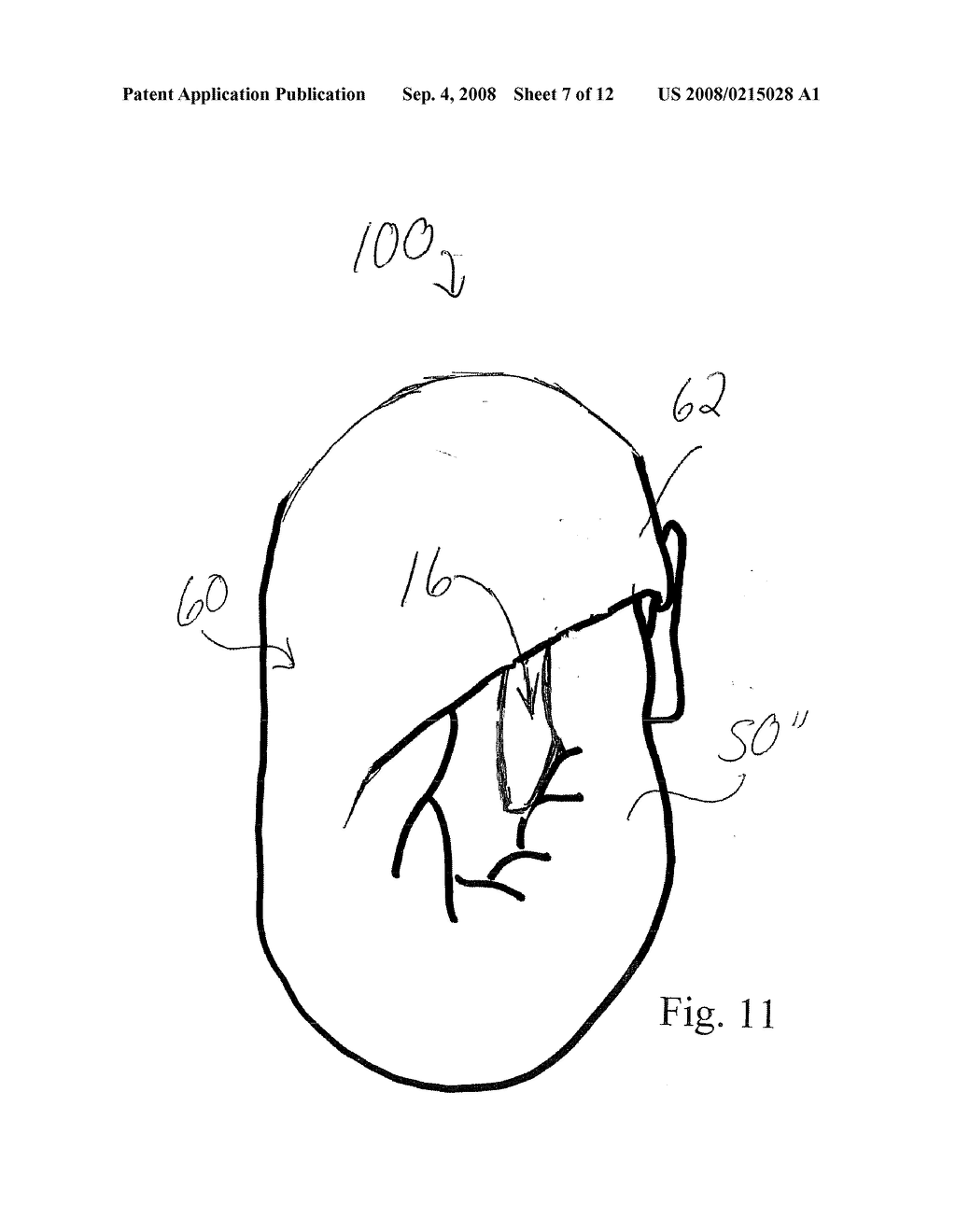 HIGHLY-ADJUSTABLE, FITTED CLOTH DIAPER - diagram, schematic, and image 08