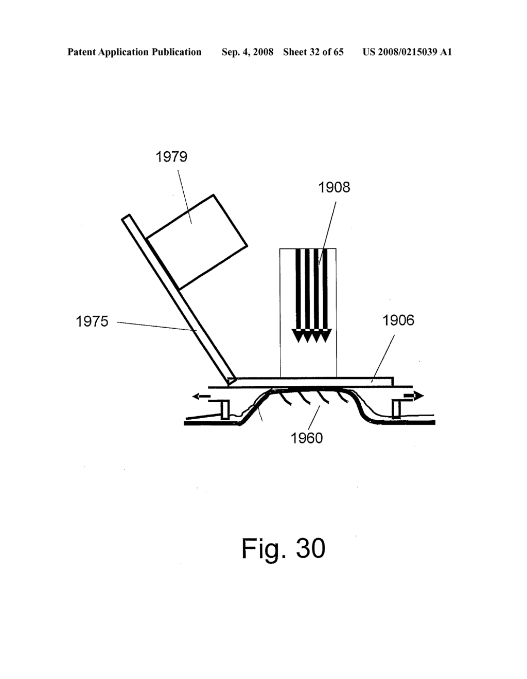 Method and Apparatus for Inhibiting Pain Signals During Vacuum-Assisted Medical Treatments of the Skin - diagram, schematic, and image 33