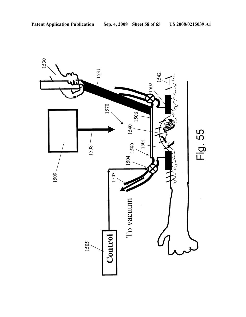 Method and Apparatus for Inhibiting Pain Signals During Vacuum-Assisted Medical Treatments of the Skin - diagram, schematic, and image 59