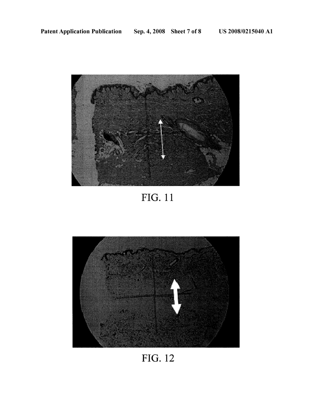 VARIABLE DEPTH SKIN HEATING WITH LASERS - diagram, schematic, and image 08