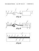 Needle or catheter for the thermal coagulation of blood vessels diagram and image