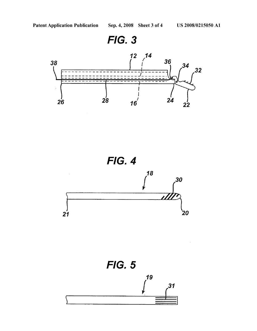 TISSUE ENGAGING HEMOSTASIS DEVICE - diagram, schematic, and image 04