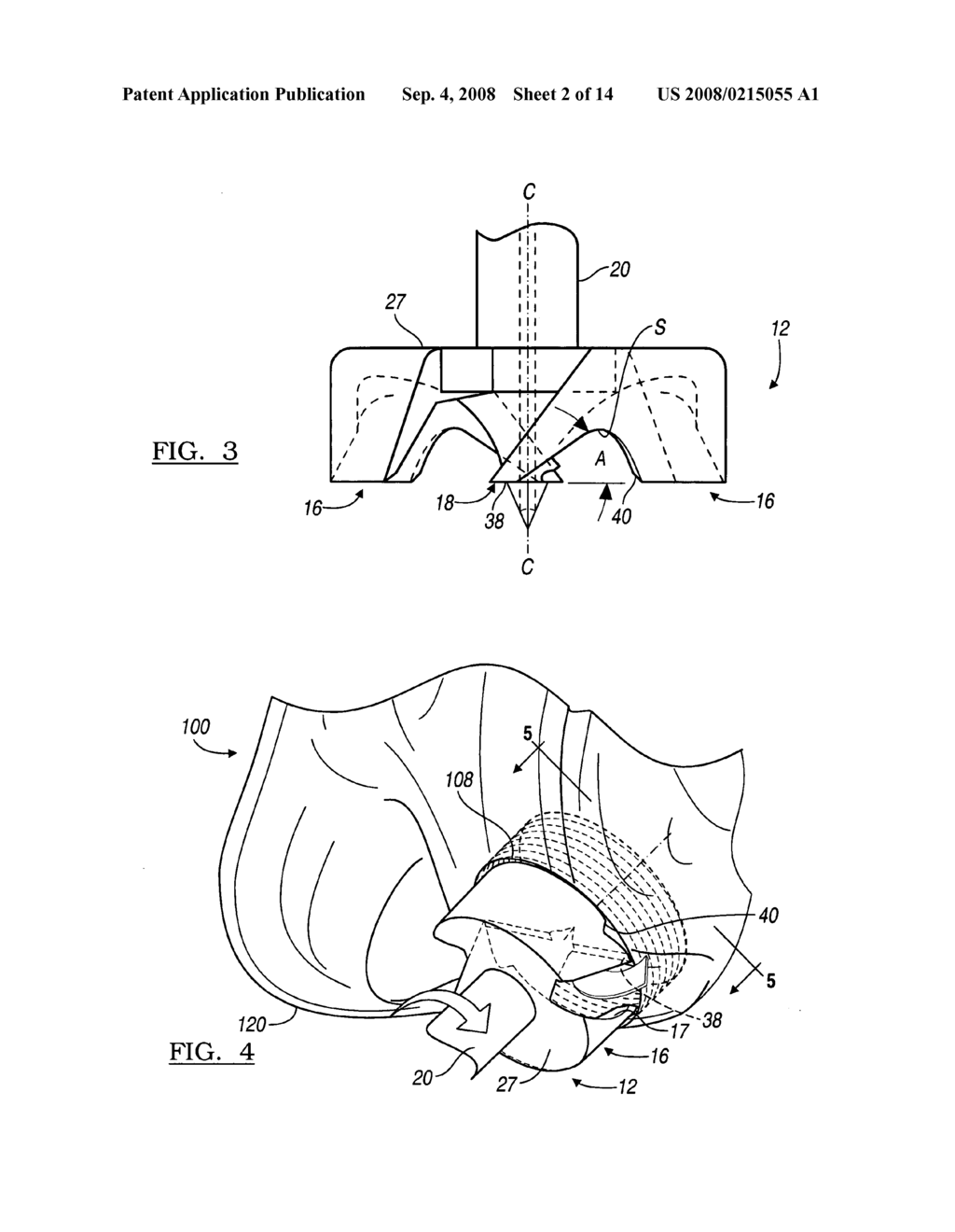 Method and apparatus for a planar drill - diagram, schematic, and image 03