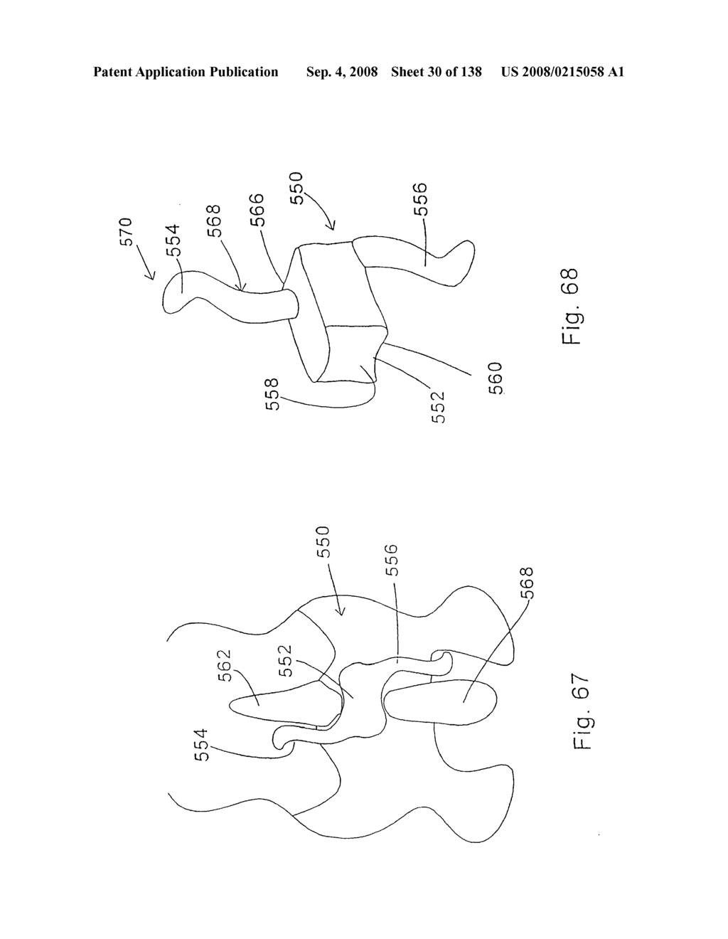 Spine distraction implant and method - diagram, schematic, and image 32