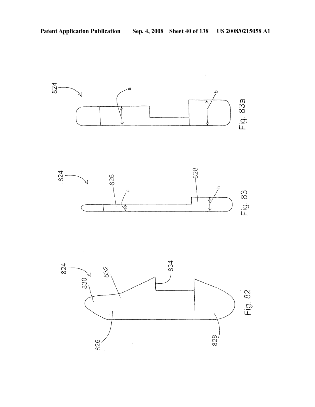 Spine distraction implant and method - diagram, schematic, and image 42