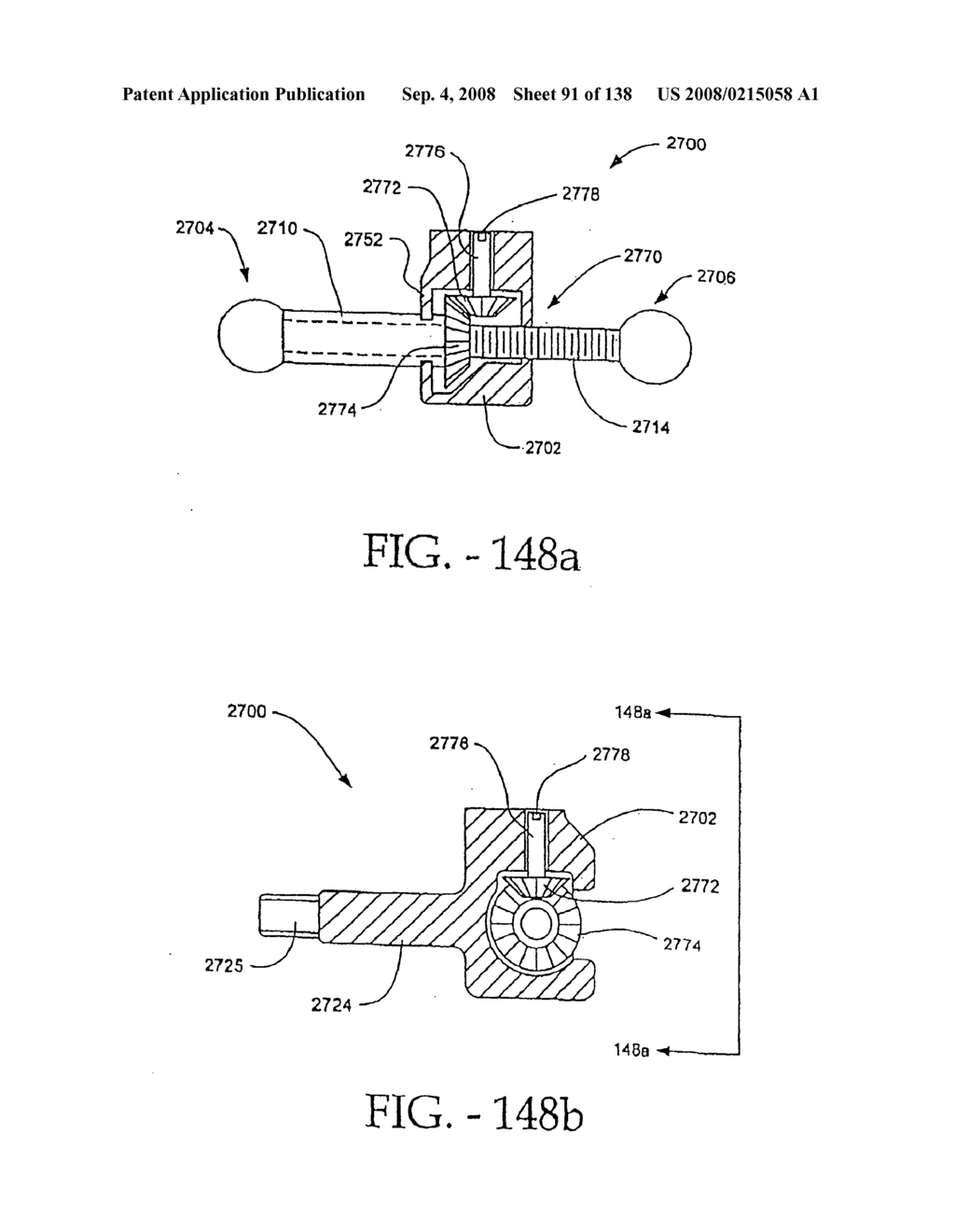 Spine distraction implant and method - diagram, schematic, and image 93