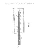 Systems, methods and devices for removing obstructions from a blood vessel diagram and image