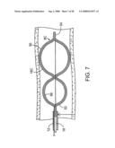 Systems, methods and devices for removing obstructions from a blood vessel diagram and image