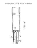 Systems, methods and devices for removing obstructions from a blood vessel diagram and image