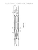 Systems, methods and devices for removing obstructions from a blood vessel diagram and image