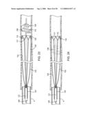 Systems, methods and devices for removing obstructions from a blood vessel diagram and image