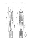 Systems, methods and devices for removing obstructions from a blood vessel diagram and image