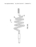 Systems, methods and devices for removing obstructions from a blood vessel diagram and image