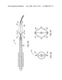 Systems, methods and devices for removing obstructions from a blood vessel diagram and image