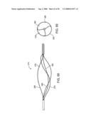 Systems, methods and devices for removing obstructions from a blood vessel diagram and image