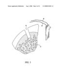 GRAFT FIXATION USING A PLUG AGAINST SUTURE diagram and image