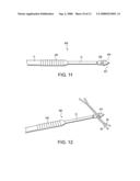 GRAFT FIXATION USING A PLUG AGAINST SUTURE diagram and image