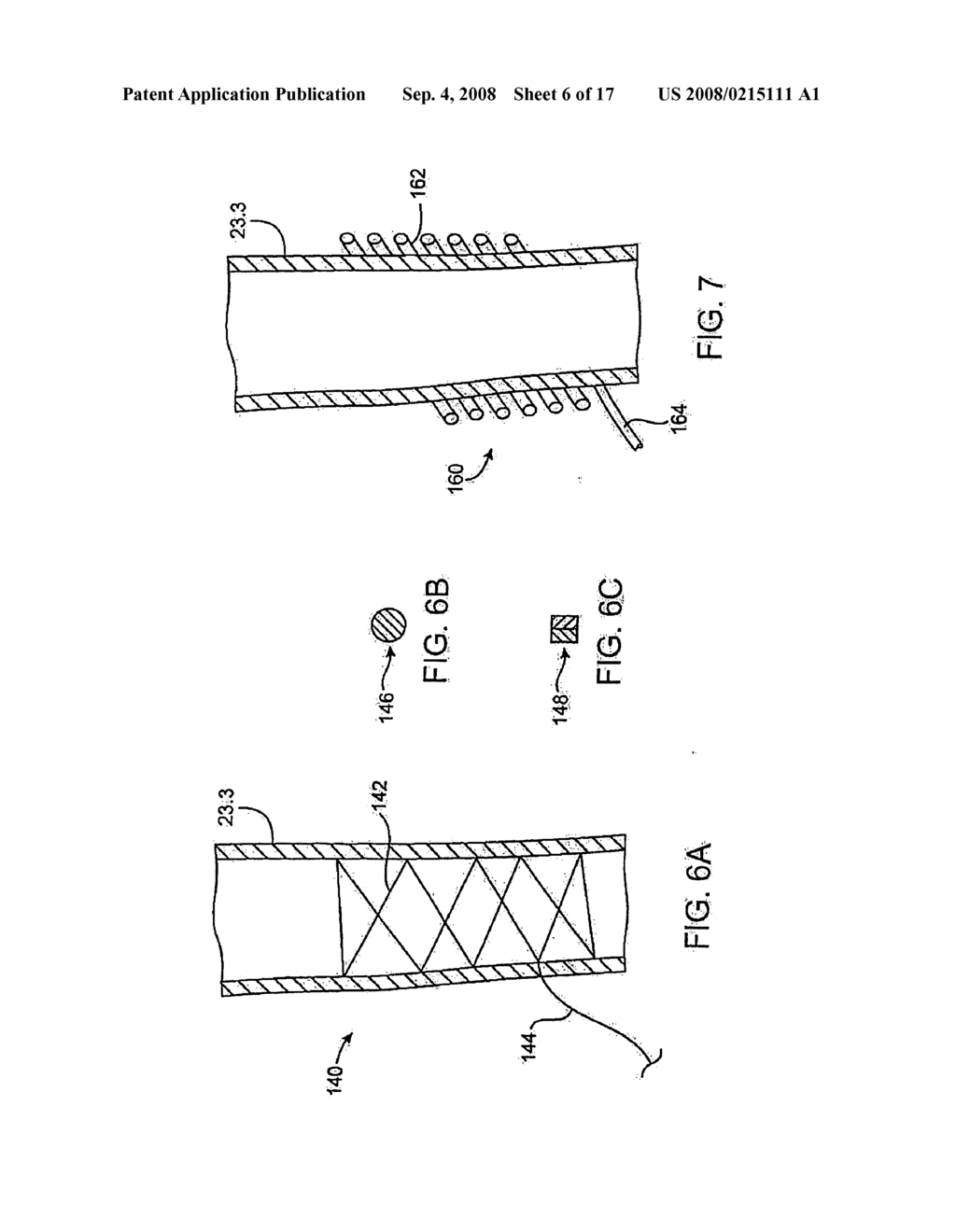 Devices and Methods for Cardiovascular Reflex Control - diagram, schematic, and image 07