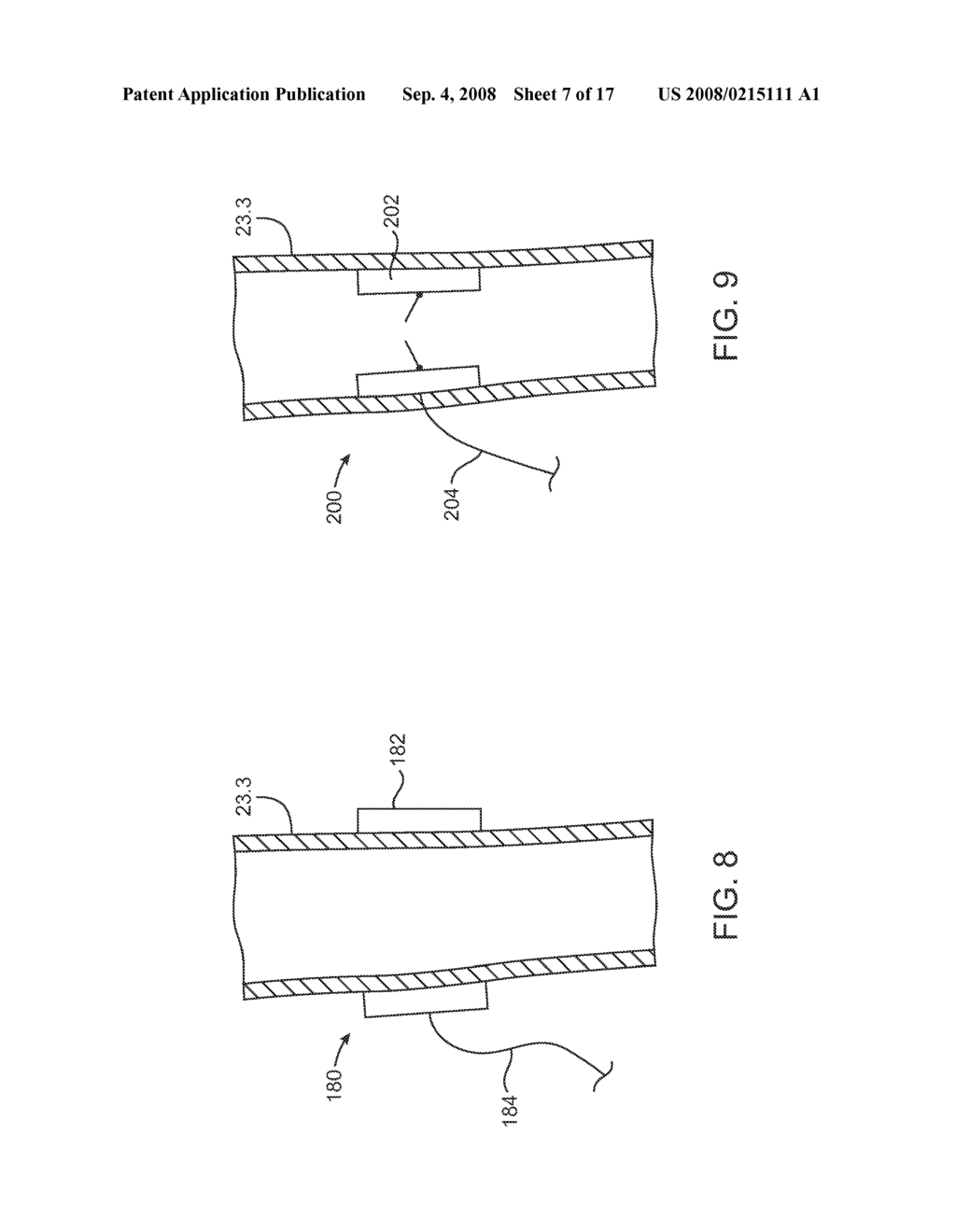 Devices and Methods for Cardiovascular Reflex Control - diagram, schematic, and image 08