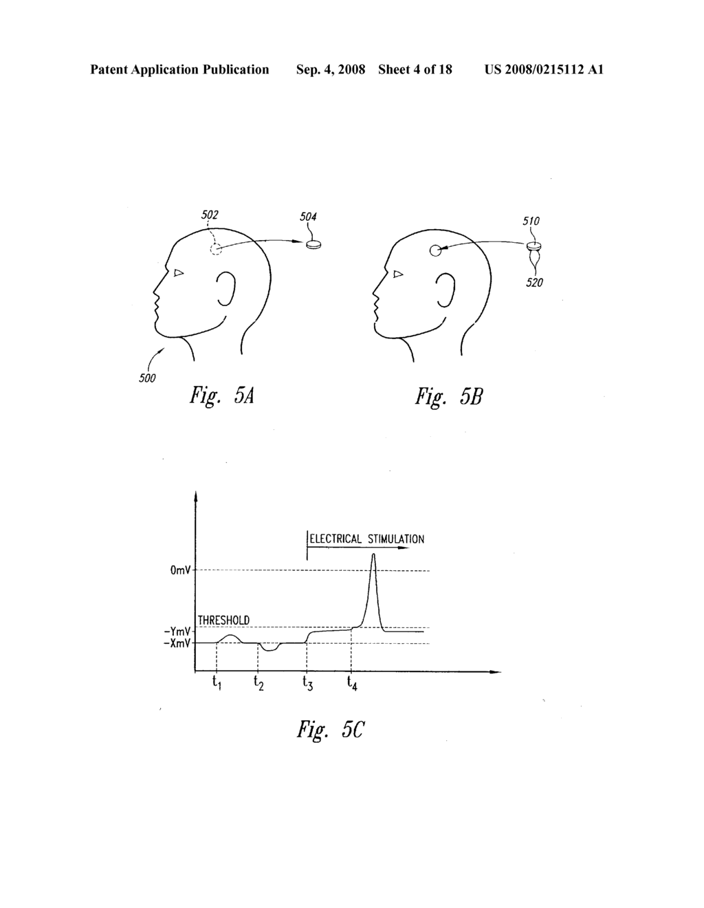 METHODS AND APPARATUS FOR EFFECTUATING A LASTING CHANGE IN A NEURAL-FUNCTION OF A PATIENT - diagram, schematic, and image 05