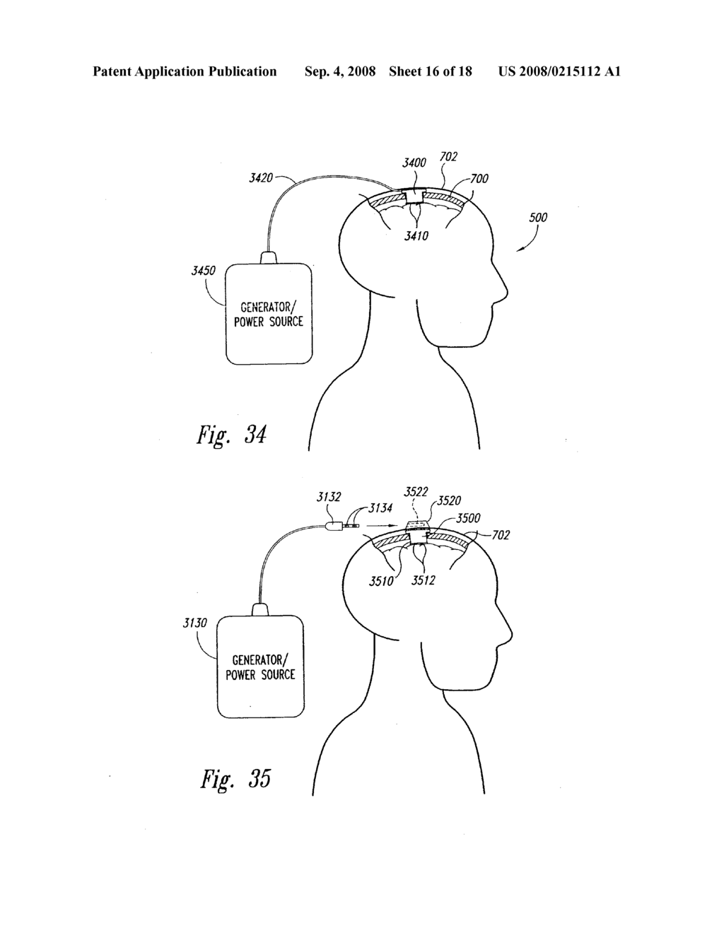 METHODS AND APPARATUS FOR EFFECTUATING A LASTING CHANGE IN A NEURAL-FUNCTION OF A PATIENT - diagram, schematic, and image 17