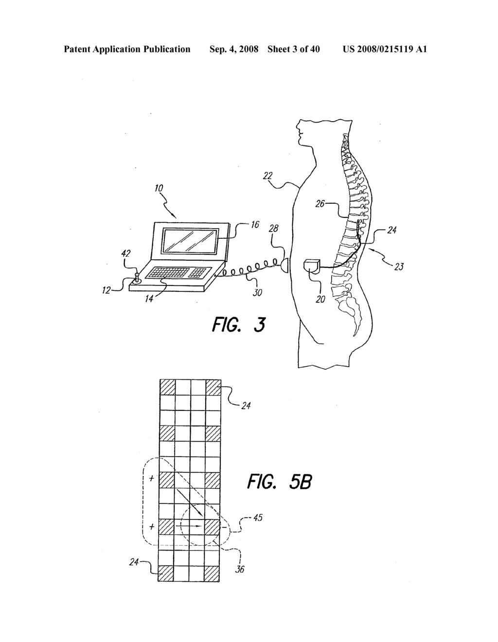 SYSTEM AND METHOD FOR DISPLAYING STIMULATION FIELD GENERATED BY ELECTRODE ARRAY - diagram, schematic, and image 04