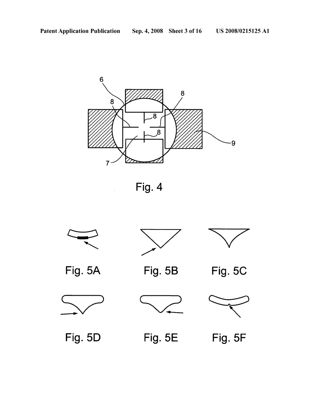 Directional stimulation of neural tissue - diagram, schematic, and image 04