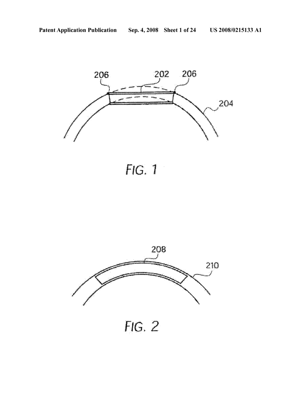 LONGITUDINALLY FLEXIBLE STENT - diagram, schematic, and image 02