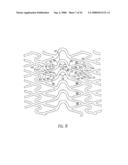 LONGITUDINALLY FLEXIBLE STENT diagram and image