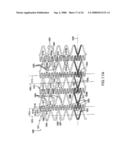 LONGITUDINALLY FLEXIBLE STENT diagram and image