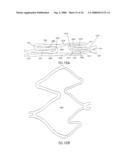 LONGITUDINALLY FLEXIBLE STENT diagram and image