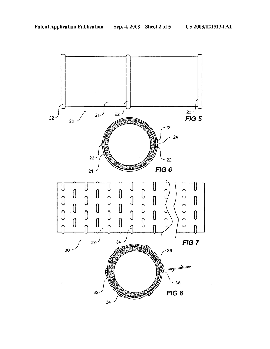 Vascular band - diagram, schematic, and image 03