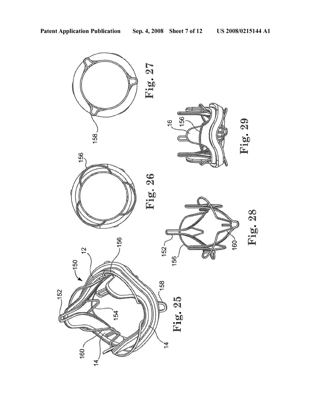 Replacement prosthetic heart valves and methods of implantation - diagram, schematic, and image 08