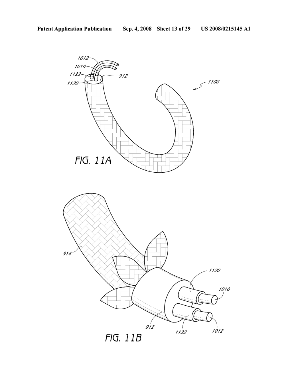 CARDIAC VALVE IMPLANT WITH ENERGY ABSORBING MATERIAL - diagram, schematic, and image 14