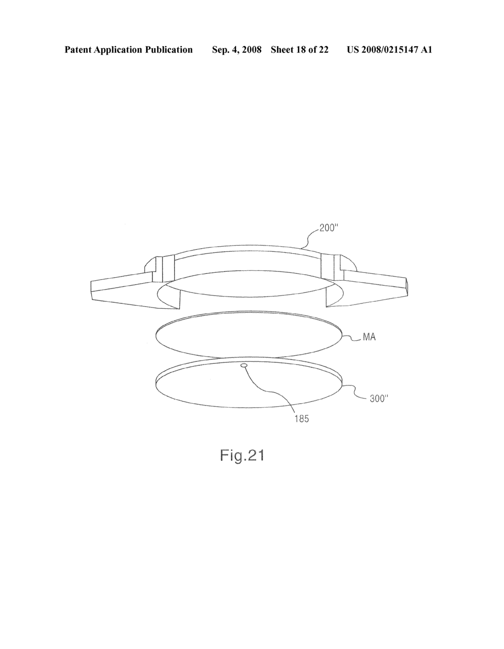 Intraocular lens system - diagram, schematic, and image 19