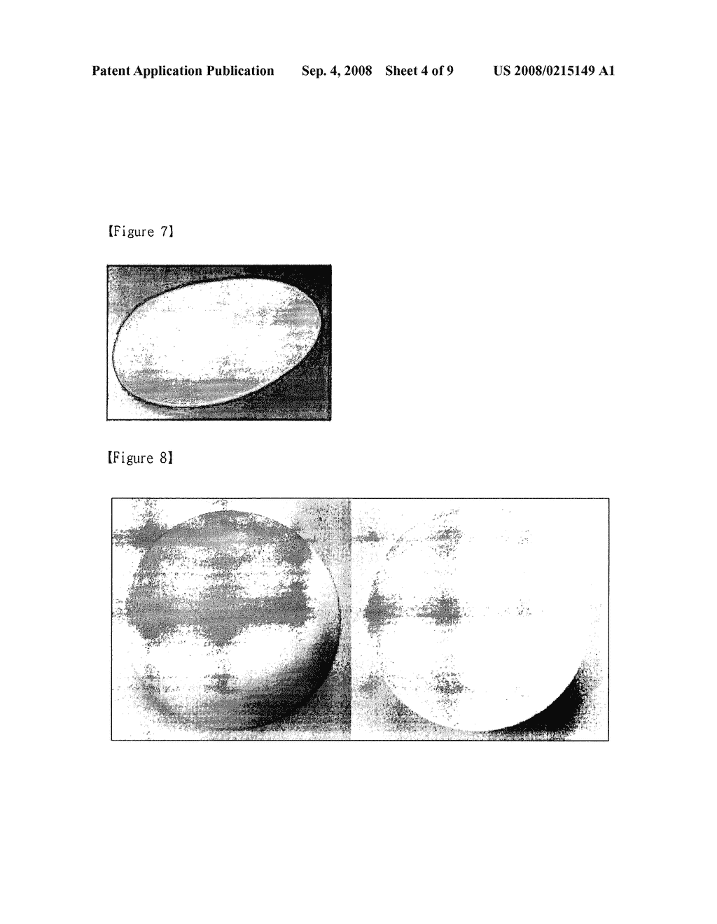 Lightweight Silicone Implant and Manufacturing Method Thereof - diagram, schematic, and image 05