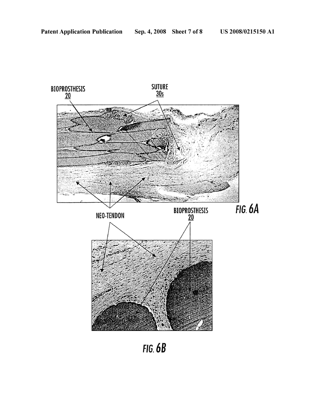 TENDON OR LIGAMENT BIOPROSTHESES AND METHODS OF MAKING SAME - diagram, schematic, and image 08