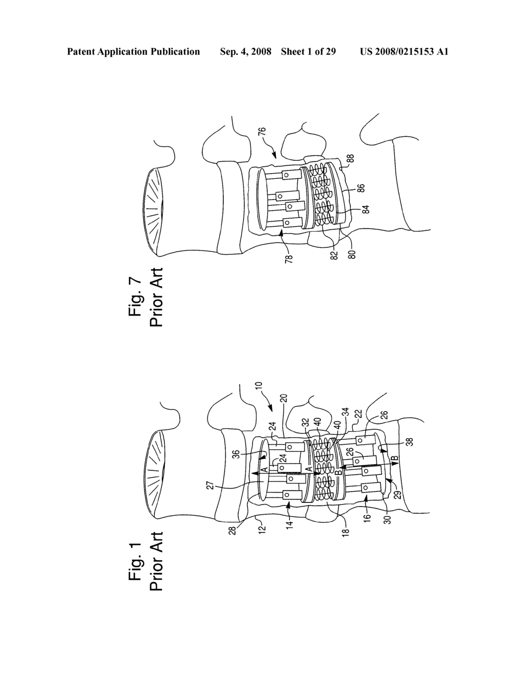 APPARATUS AND METHOD FOR PERFORMING SPINAL SURGERY - diagram, schematic, and image 02