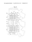 APPARATUS AND METHOD FOR PERFORMING SPINAL SURGERY diagram and image