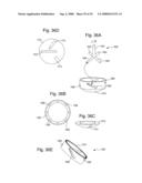 APPARATUS AND METHOD FOR PERFORMING SPINAL SURGERY diagram and image