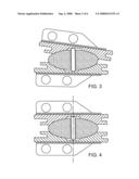 INTERVERTEBRAL PROSTHETIC DISC diagram and image