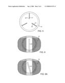 INTERVERTEBRAL PROSTHETIC DISC diagram and image