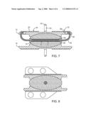 INTERVERTEBRAL PROSTHETIC DISC diagram and image