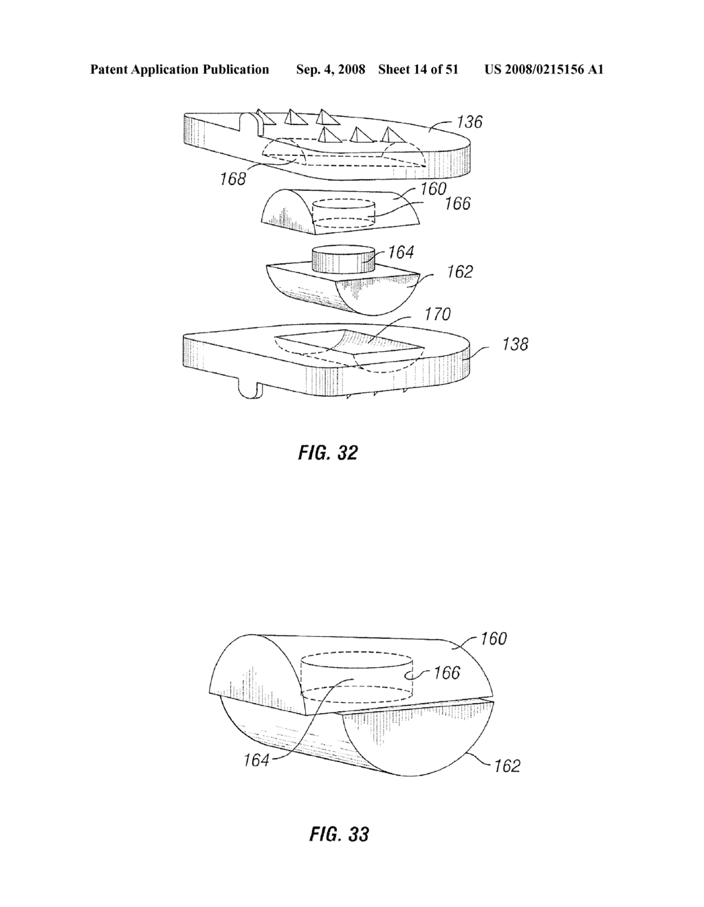 Joint Prostheses - diagram, schematic, and image 15