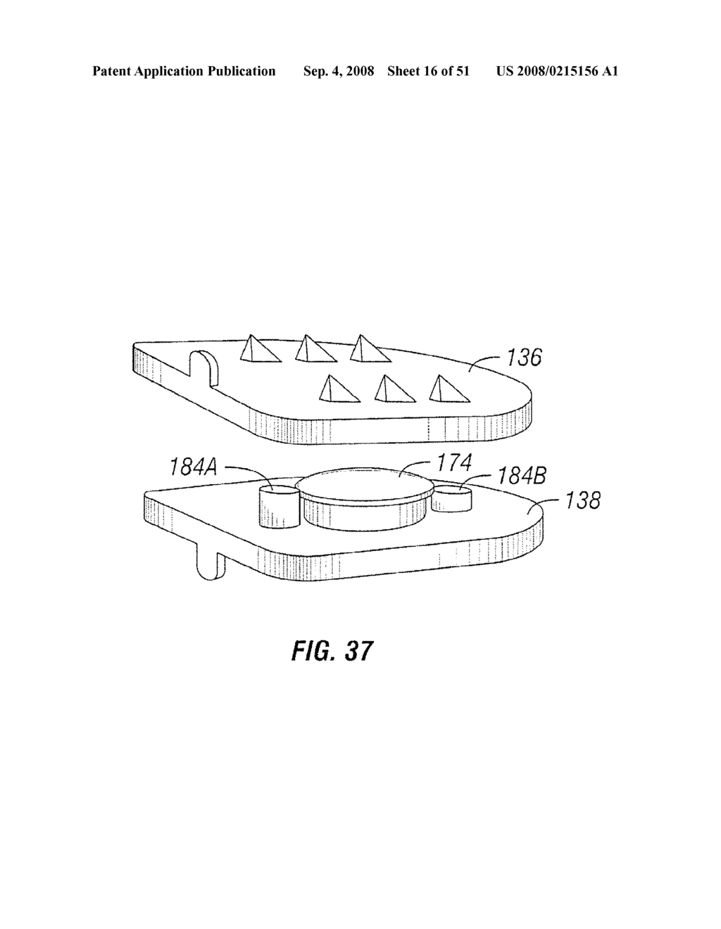 Joint Prostheses - diagram, schematic, and image 17