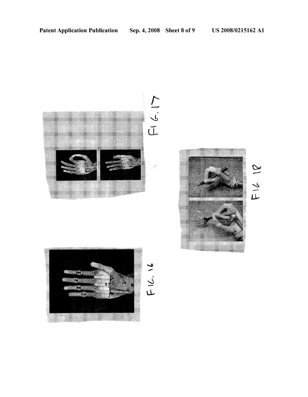 SYSTEM AND METHOD FOR USING A DIGIT TO POSITION A PROSTHETIC OR ORTHOTIC DEVICE - diagram, schematic, and image 09