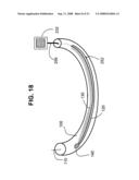 Airway imaging system diagram and image