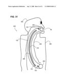 Airway imaging system diagram and image