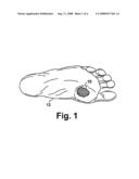 Angiogenesis initation and growth diagram and image